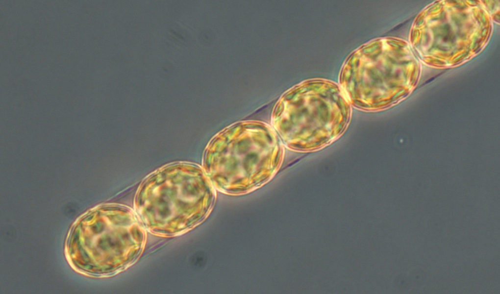 Kiselalgen Melosira arctica