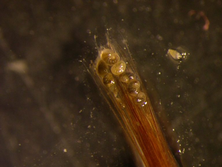 En Foraminiferer, vilket är ett litet encelligt skaldjur.