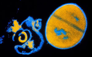 Bilden visar effekten av ett antibiotikum på bakterien Staphylococcus aureus. Till vänster syns resterna av en dödad bakterie. Bakterien till höger är än så länge oskadad och är i färd med att dela sig. Staphylococcus aureus har utvecklat ett antal varianter som är antibiotikaresistenta.