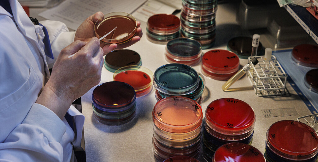 Person stryker bakterier på agarplatta.